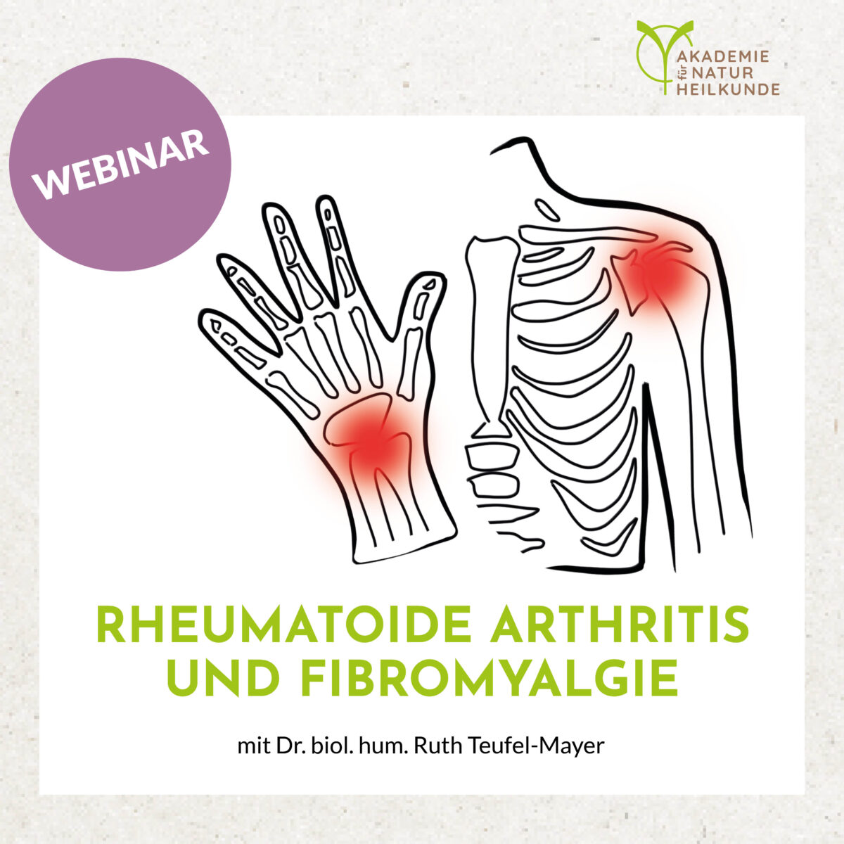 Rheumatoide Arthritis und Fibromyalgie